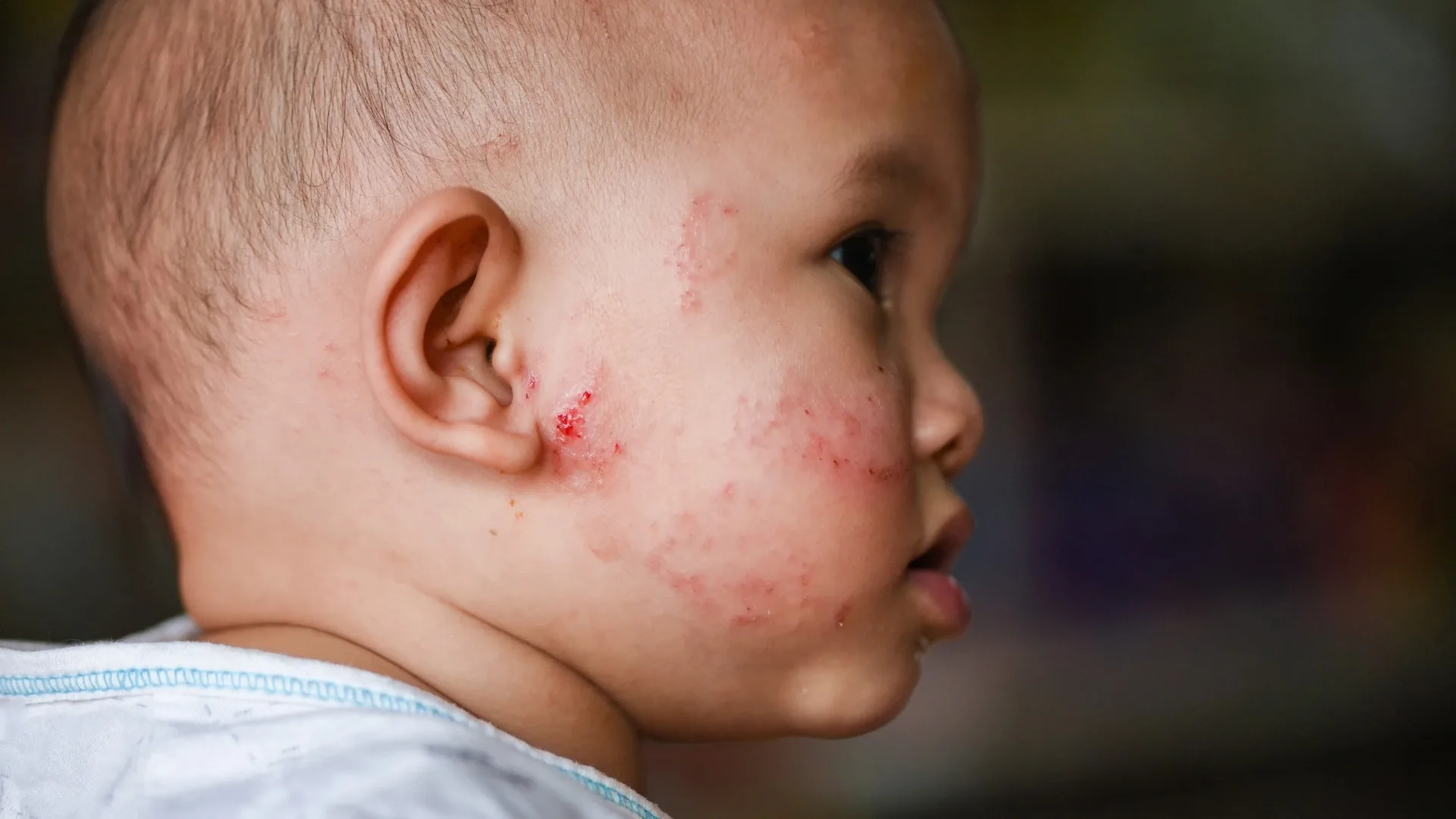 Signs That Skin Changes May Need Medical Evaluation