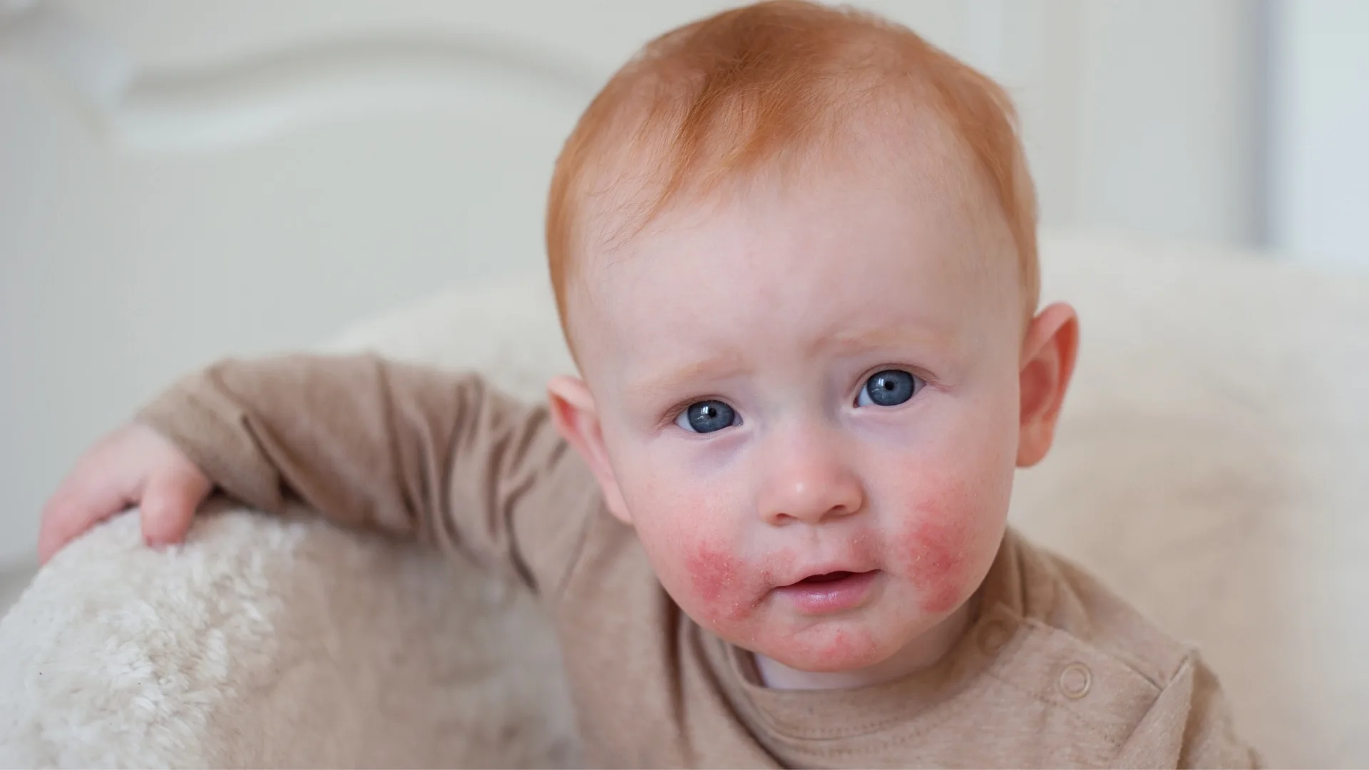 Infant Formula Allergy Symptoms and Solutions: A Parent’s Guide